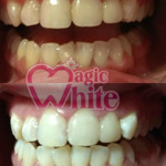 ​Студия косметического отбеливания зубов «Magic White» - фото