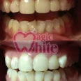 ​Студия косметического отбеливания зубов «Magic White» - Улан-Удэ