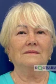Бичурина Людмила Кирилловна - Сочи