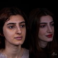 Фото Клиника пластической хирургии Рауфа Юсифзаде