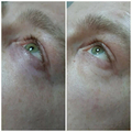 Фото Клиника лазерной эпиляции и косметологии «Cleanskin»