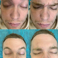 Фото Клиника лазерной эпиляции и косметологии «Cleanskin»