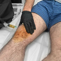 Фото Клиника спортивной медицины «Smart Recovery»