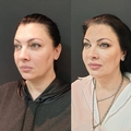 Фото Медико-косметологический центр «Онегин» на Писарева