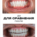 Фото Стоматологическая клиника Dr. Vartan Sarkisian