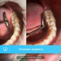 Фото Стоматологическая клиника «Мед-Дент»