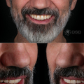 Фото Стоматология «Digital Smile Design»