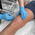 Фото Клиника спортивной медицины «Smart Recovery»