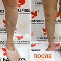 Фото Клиника «Стоп Варикоз»