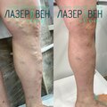 Фото Клиника лазерной хирургии «ЛазерВен»