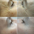Фото Клиника лазерной эпиляции и косметологии «Cleanskin»