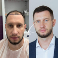 Фото Центр по пересадке волос на Никитском бульваре