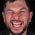 Фото Стоматология «Digital Smile Design»