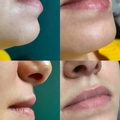 Фото Клиника лазерной эпиляции и косметологии «Cleanskin»
