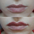 Фото Клиника лазерной эпиляции и косметологии «Cleanskin»