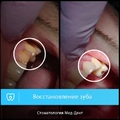 Фото Стоматологическая клиника «Мед-Дент»