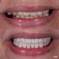 Фото Стоматологическая клиника «Garant Smile» на Длинной