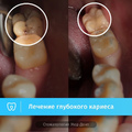 Фото Стоматологическая клиника «Мед-Дент»