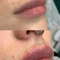 Фото Клиника лазерной эпиляции и косметологии «Cleanskin»