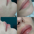 Фото Клиника лазерной эпиляции и косметологии «Cleanskin»