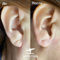 Фото Клиника косметологии «Amster Dama»