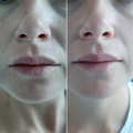 Фото Клиника лазерной эпиляции и косметологии «Cleanskin»