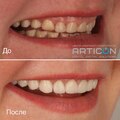 Фото Центр цифровой стоматологии «Артикон»