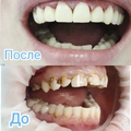 Фото Дента Эстет в Климовске