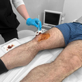 Фото Клиника спортивной медицины «Smart Recovery»