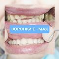 Фото Дента Эстет в Климовске
