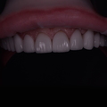 Фото Стоматология «Luxury Smile»