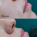 Фото Клиника лазерной эпиляции и косметологии «Cleanskin»