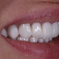 Фото Стоматологическая клиника «Garant Smile» на Длинной