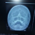 Фото SNORING CLINIC на Литейном проспекте
