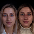 Фото Клиника пластической хирургии Рауфа Юсифзаде