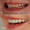 Фото Центр цифровой стоматологии «Артикон»