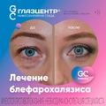 Фото Глазная клиника «ГлазЦентр»