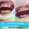Фото Стоматологическая клиника «Мед-Дент»