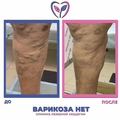 Фото Клиника «Варикоза нет»