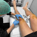 Фото Клиника спортивной медицины «Smart Recovery»