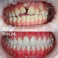 Фото Стоматологическая клиника «Home Dental»