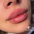 Фото Клиника косметологии «Amster Dama»