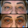 Фото Миц Артур Николаевич