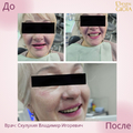 Фото Схулухия Владимер Игорьевич