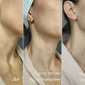 Фото Швецова Лариса Владимировна