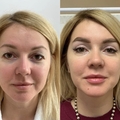 Фото Выступец Борис Владимирович